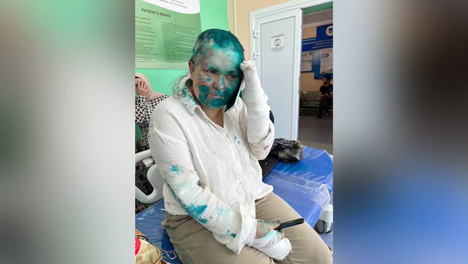 Agreden brutalmente a periodista rusa en Chechenia: su estado es "complicado"