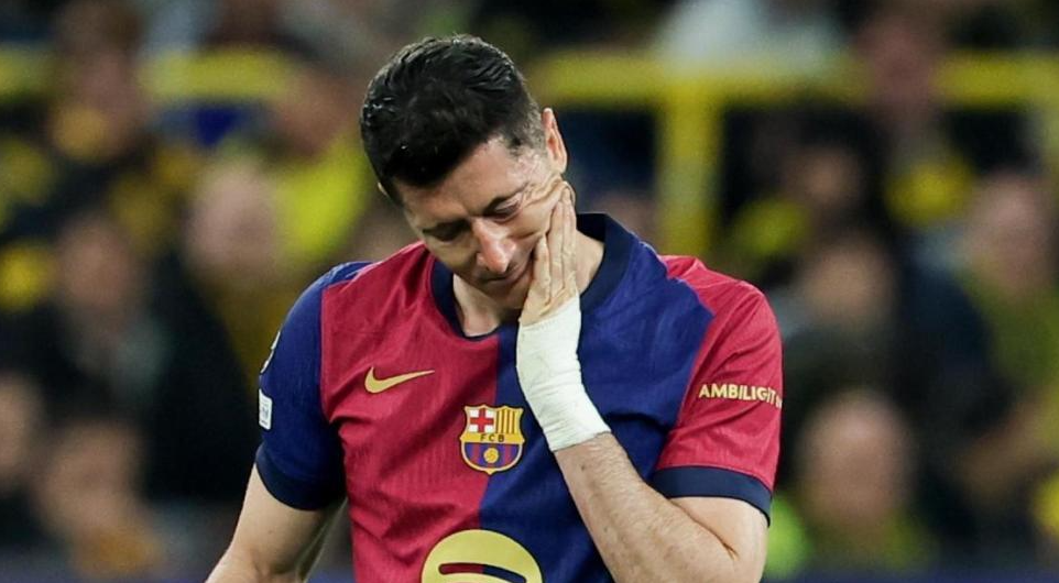 Lewandowski se lesiona y es duda para el Clásico