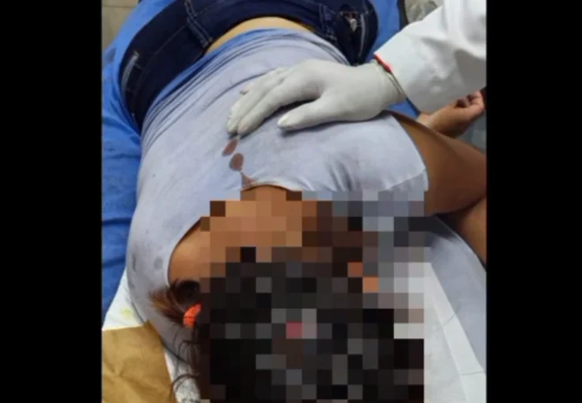 Toro embistió tres veces a una mujer en Lagunillas