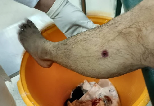 Denuncian intento de homicidio contra un repartidor en San Jacinto: Recibió un disparo en la pierna