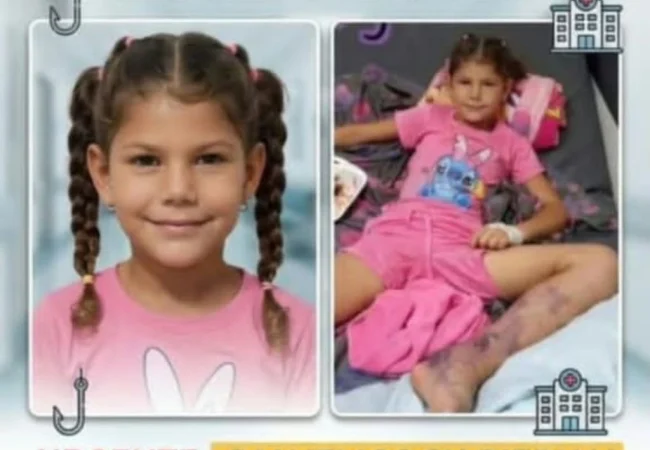 Mariangelis Paz requiere ayuda urgente tras sufrir grave herida por la hincada de un bagre